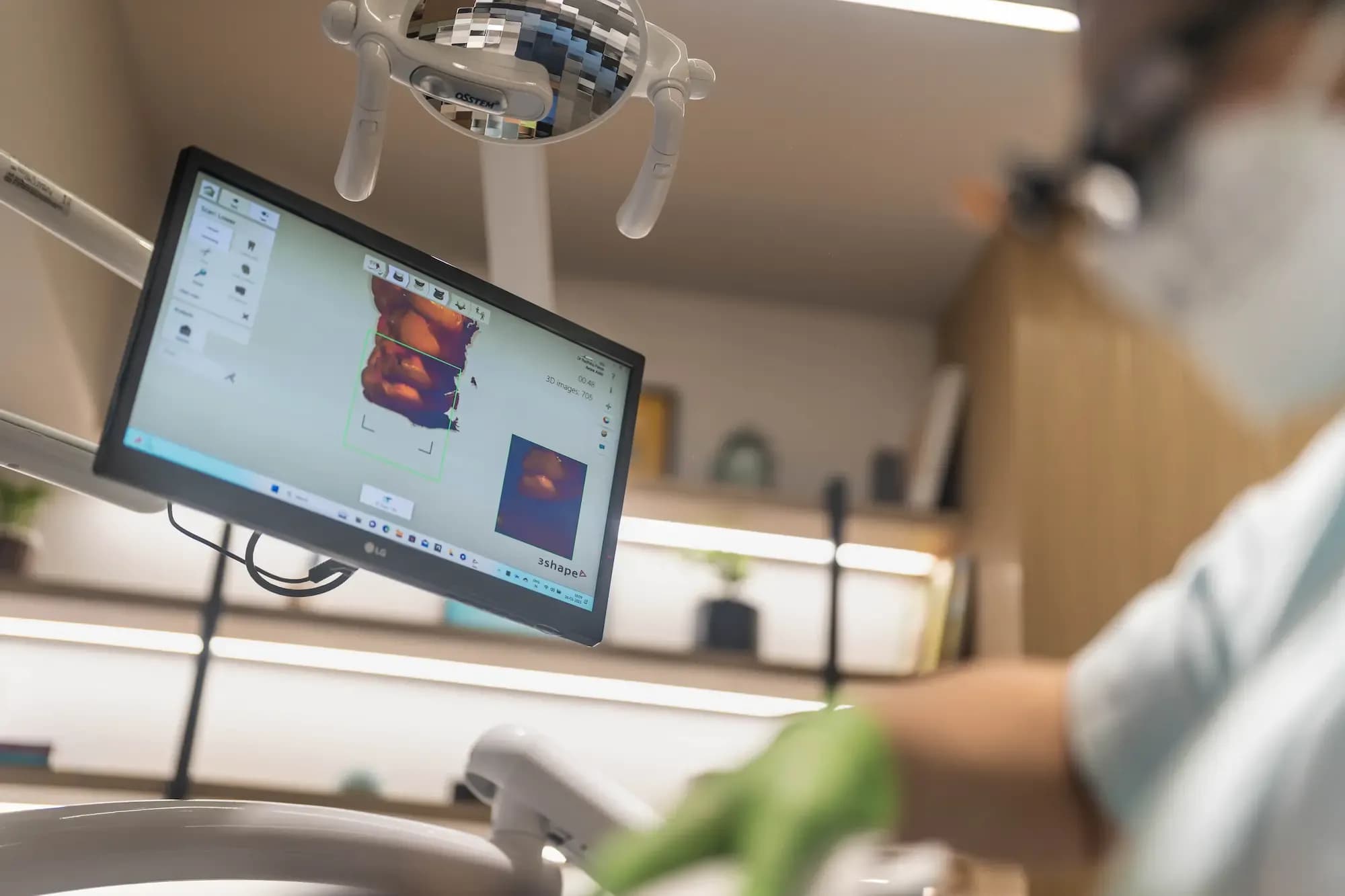3D-Scanning Teeth to create one day crowns and mouthguard digital Dentistry